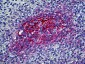 CR2 / CD21 Antibody (clone 2G9)